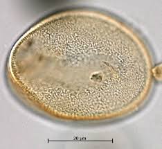 Image result for Anthericaceae