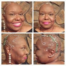 This Is Called Chandelier Celebrating Hair Loss After Cancer Shared By  Shay-la Phillips