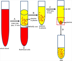 View treatments prices & details, doctor profiles, clinic contact information and photos. Rejuvenation Of Ovary And Thin Endometrium By Autologous Prp Injection In Por And Recurrent Implantation Failure