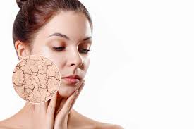Image result for Dry Skin Management