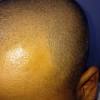 ··· serum hair hair loss serum minoxidil custom mintop serum growth extra oil regrowth hair loss restoration shampoo. 1