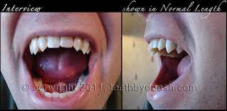 Check spelling or type a new query. Teeth By Dnash Custom Vampire Fangs Werewolf Teeth And Dental Effects Custom Fang Styles