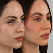 Ghavami Plastic Surgery