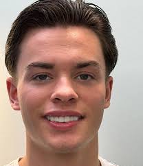 World snooker champ Leon Crowleys handsome transformation 💙