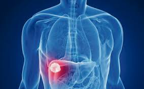 As the tumor size increases, it may cause pain in the right side of the abdomen. 9 Warning Signs For Liver Cancer