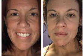 Fundraiser for Emily Latham by Beth Seagrave : Help Emily Kick Cancer's Ass