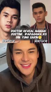 Doctor Rev3al naman dyan Dustin #dustinpbb #dustinyu  #PBBCelebrityCollabEdition #viralpost2025シ #ccto #artist  #forentertainmentporpusesonly