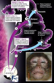 Monkeypox is caused by the monkeypox virus. Monkeypox Outbreak Fears Grow As Healthcare Worker Becomes Third Person To Catch Deadly Disease In Uk