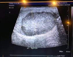 Remembering that sometimes it's grey these are the considerations the mod team use when 4. Fox News Testicle Pictures On Reddit Saved This Bearded Man S Life The Atlantic