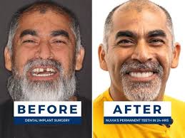 THE BEST 10 PROSTHODONTISTS in THORNTON, CO