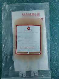 Image result for Plasma Transfusion