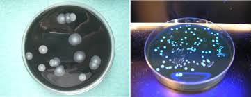 Portail des communes de france : The Philly Killer Emergence De Legionella Pneumophila Bacterie Ubiquitaire De L Environnement Encyclopedie De L Environnement