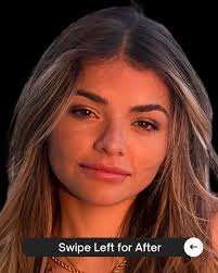 Gustavo Colberg MD, Cirujano Plástico