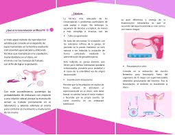 It is a fertility treatment for humans, and is common practice in animal breeding, including dairy cattle (see frozen bovine semen) and pigs. Triptico Sobre La Fertilizacion Artificial Docsity