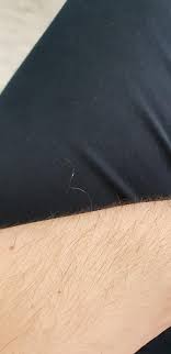 Although white hair is characteristic of aging, colorless hair strands can appear at any age — even while you're still in high. My Arm Has A Single Super Long White Hair Mildlyinteresting