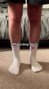 Image result for Foot Drop