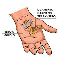 Photos, address, and phone number, opening hours, photos, and user reviews on yandex.maps. Operacion Del Sindrome Del Tunel Carpiano Hospital Fuensanta Madrid