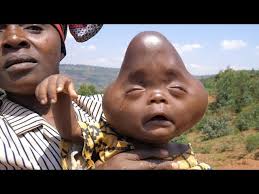 Fundraiser by Private Ineza : Help This Baby To Get Advanced Treatment