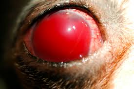 Image result for Hyphema