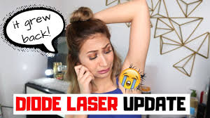 *full contact type lighting, hair removal safer. Affordable Underarm Laser Hair Removal Update Diode Laser Hair Removal Lolly Isabel Youtube