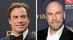 Luckily there are measures nowadays that not only save your hair but can provide an incredible transformation. Celebrities With Hair Transplants List Of Famous Men With Transplants