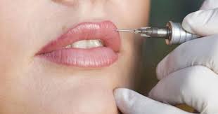 Check spelling or type a new query. Ini 5 Penyebab Bibir Bengkak Pasca Bangun Pagi Jangan Lekas Panik