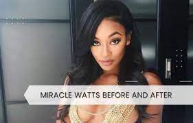 Miracle watts surgery
