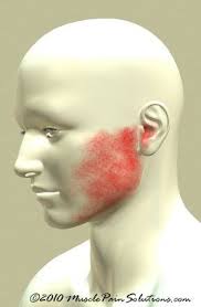 Pin On Jaw Joint Pain Relief