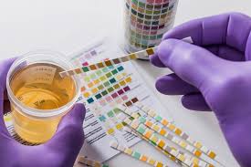 What Can Cause a False Positive Drug Test