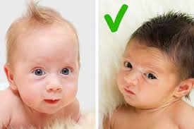 Namun, beberapa gangguan mata pada anak bisa juga berupa bawaan lahir. 5 Kelainan Mata Pada Bayi Yang Bisa Dideteksi Orangtua Salah Staunya Perhatikan Hasil Foto Semua Halaman Grid Health