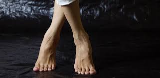 De doua zile am o senzatie de arsura la nivelul pielii în partea din fata a piciorului drept. Umflarea Picioarelor In Cancer Cauze Si Tratament Cancer360