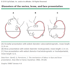 Image result for Face Presentation