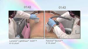 Electrology laser clinic not only offers the best solutions for permanent hair removal, our services expand to so much more. Laser Hair Removal Richmond Va Travis Shaw Md