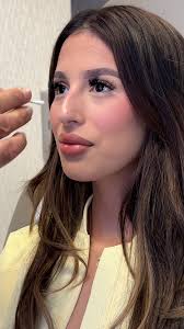 Adjusting noses one Preservation Rhinoplasty at a time 👃🏼✨ ➡️Swipe to see  this incredible before and after transformation! 👀 #preservationrhinoplasty