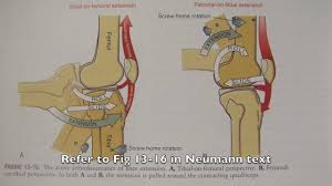 Setting up smart lock is easy and can really save you a headache. Ot 440 Kinesiology Lower Extremity Knee Locking Mechanism Youtube