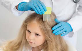 Lice Removal Treatment Somerset County