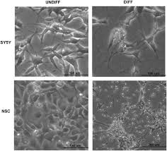 Radio fm en direct, webradios, clips, vidéos, interviews, biographies artistes ! Metabolic Enhancement Of Glycolysis And Mitochondrial Respiration Are Essential For Neuronal Differentiation Cellular Reprogramming