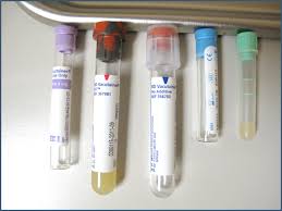 Sodium fluoride is the antiglycolytic agent. Veterinary Phlebotomy Supplies For Drawing Blood
