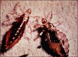 Jun 07, 2021 · asimismo, recomendó que en caso de detectar alguna picadura o infección, acudir al médico para vigilar y evitar la aparición de enfermedades como lyme, fiebre maculosa de las montañas rocosas. Fiebre De Las Trincheras Ecured