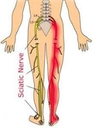 Sciatic Nerve Chart I Actually Used This Chart Several