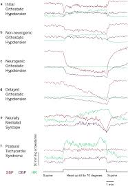 Image result for Head-Up Tilt-Table Testing