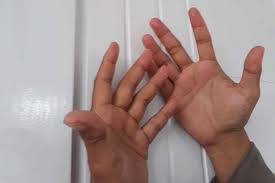 Designed for predictable capture, positioning and release in patients with mr. Memperbesar Alat Vital Bagaimana Hukumnya Islampos