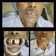 AZAD DENTAL CARE VIMLA DENTAL CARE