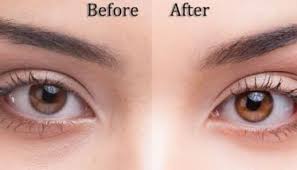 How To Change Your Eye Color Naturally With Honey Surgery Permanently Drops Online Atemberaubende Augen Augenfarbe