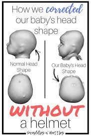 Maybe you would like to learn more about one of these? How We Fixed Our Baby S Flat Head Without A Helmet Baby Head Shape Flat Head Baby Baby Helmet