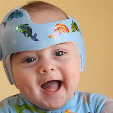 Helmet special operations helmet military full face ballistic helmet head protection novelty motorcycle helmets bike football helmet special needs helmets for children us special forces helmet bicycle helmets for women soft protective helmets for adults bulletproof helmet mask bike. Baby Helmet Therapy Parent Faqs Healthychildren Org