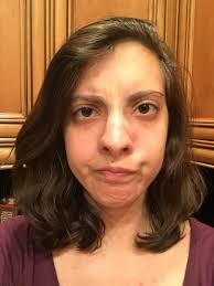 Leave it on for about 30 minutes. I Tried Using Lemon Juice And Toothpaste To Get Rid Of My Acne