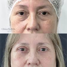 Clinica BioBelle Santiago