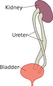 Duplicated Ureter Wikipedia