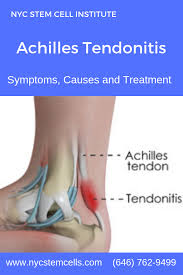 Regenerative Medicine Stem Cell Therapy For Achilles Tendonitis Achilles Tendonitis Stem Cell Therapy Cell Therapy